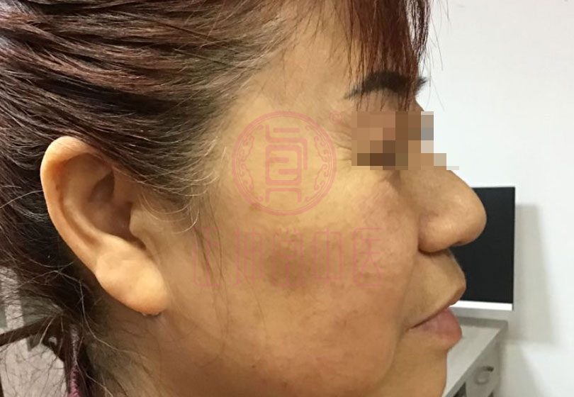 女性衰老的调理方法