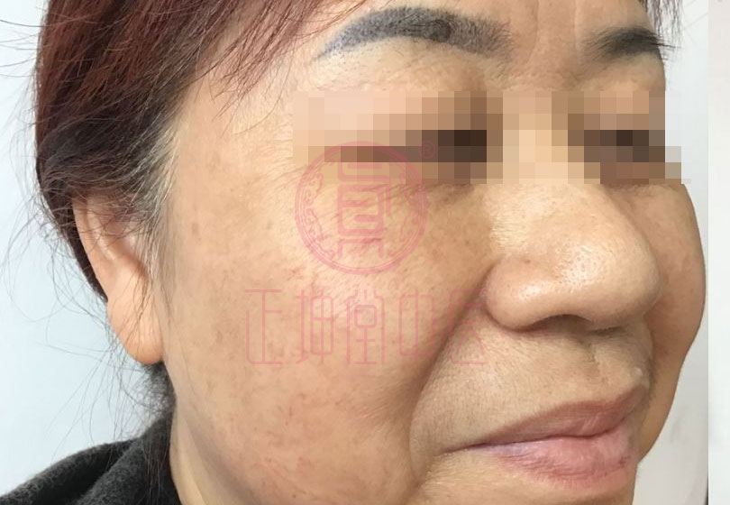 女性衰老的调理方法