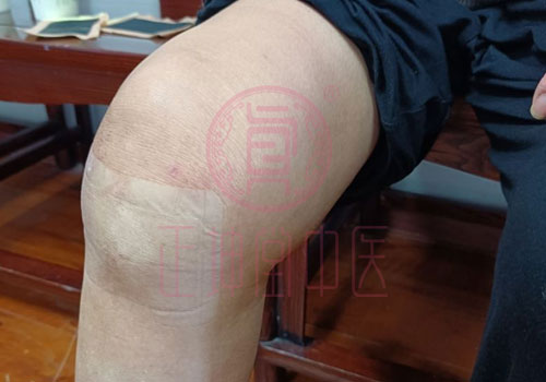 膝关节疼痛该怎么办
