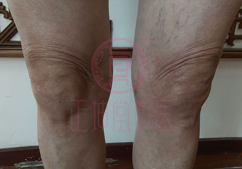 膝关节疼痛哪里治愈比较好