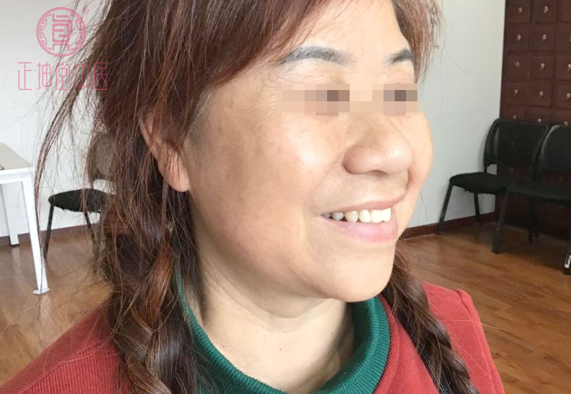 女性衰老的调理方法
