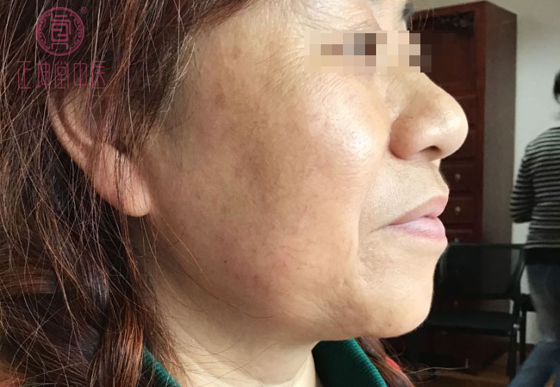 女性衰老的调理方法