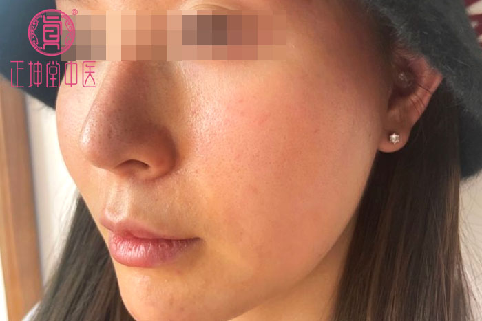 女性衰老的表现有哪些