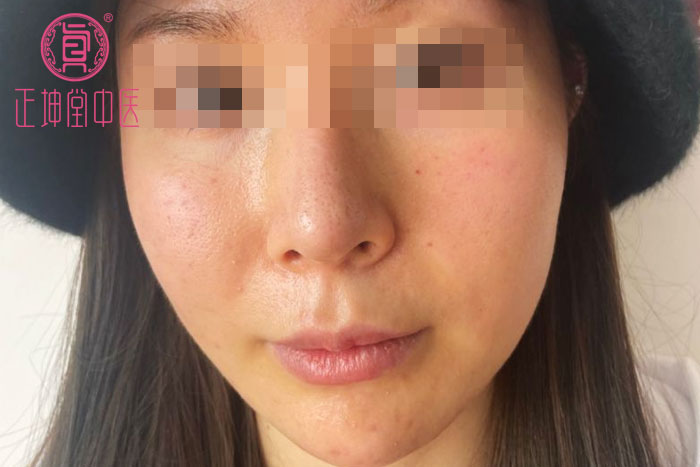 女性衰老的表现有哪些