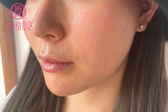 女性衰老的表现有哪些