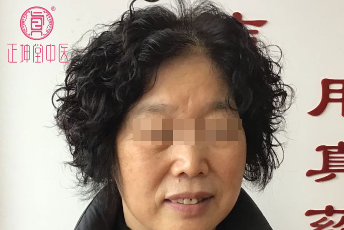 脸部衰老特别快怎么办