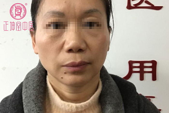 女性衰老的调理方法