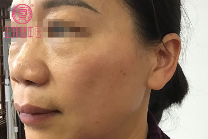 女性衰老的调理方法