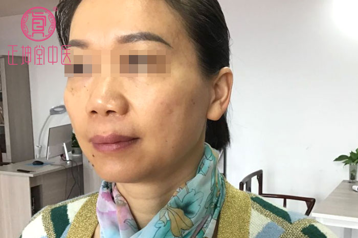 女性衰老的调理方法