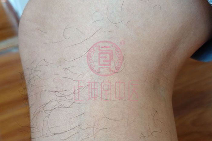 老年膝关节疼痛中医疗法
