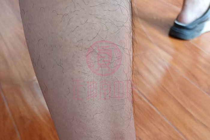 老年膝关节疼痛中医疗法