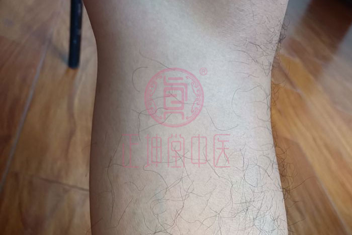 老年膝关节疼痛中医疗法