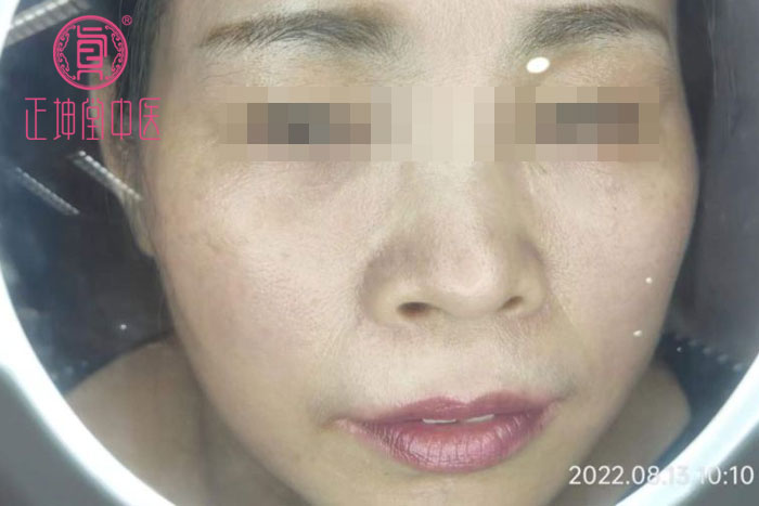 皮肤衰老的原因有哪些