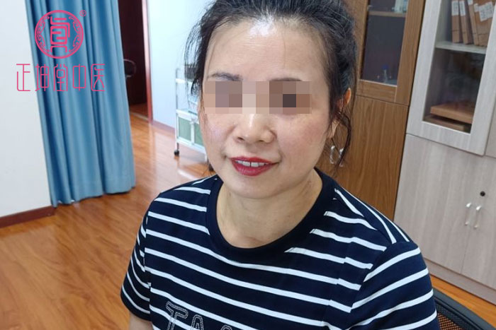 皮肤衰老的原因有哪些