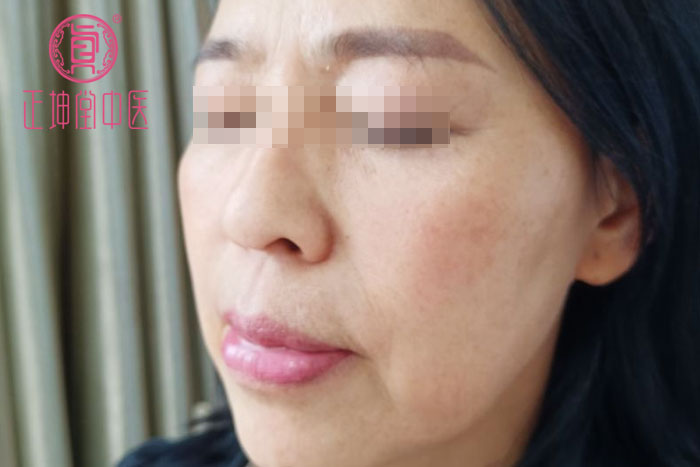 皮肤衰老的原因有哪些