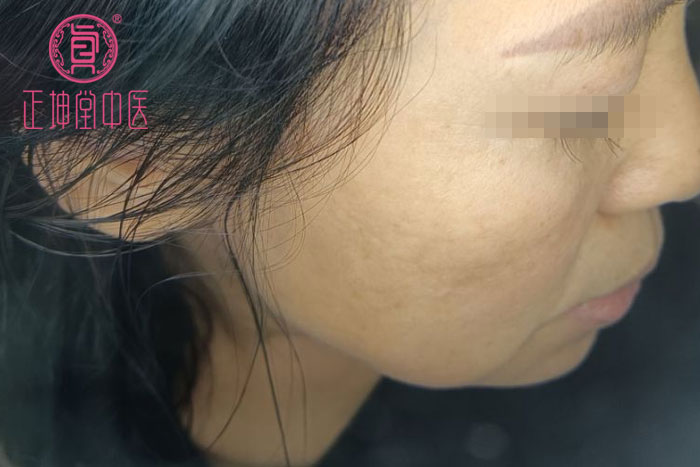 皮肤衰老的原因有哪些