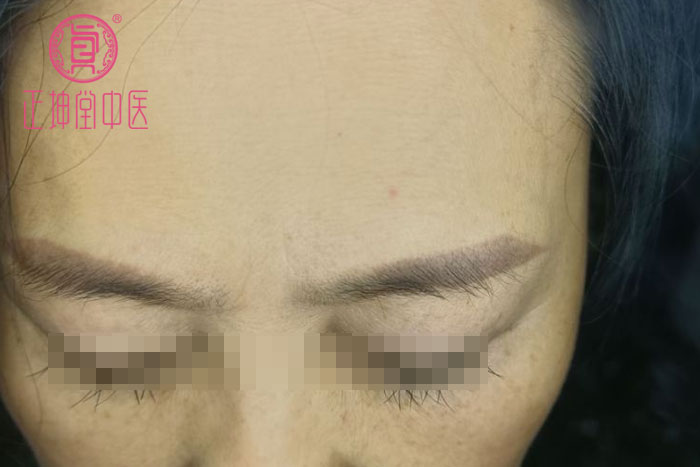 皮肤衰老的原因有哪些