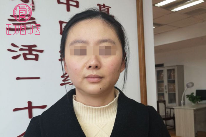 更年期衰老案例