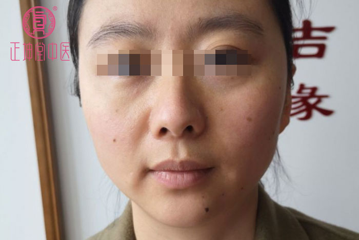 更年期衰老案例