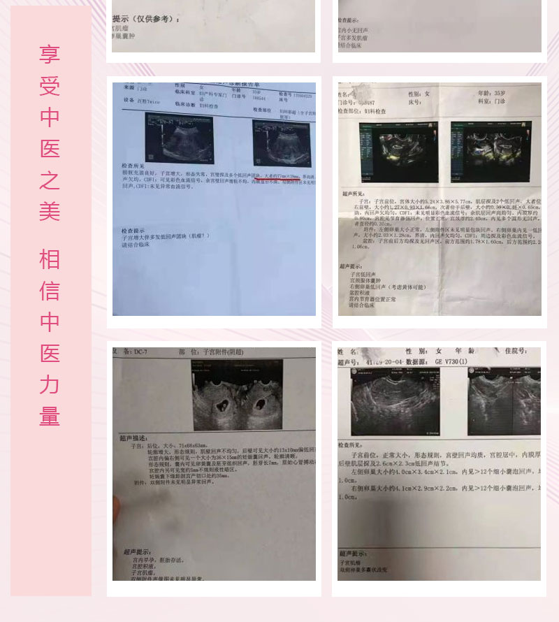 子宫肌瘤如何治疗效果好