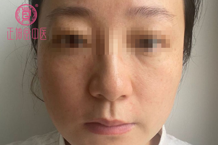 产后衰老如何调理