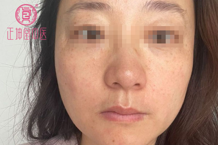 产后衰老如何调理