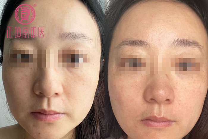 产后衰老如何调理