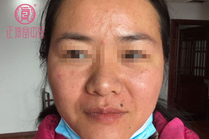 女人衰老的主要原因