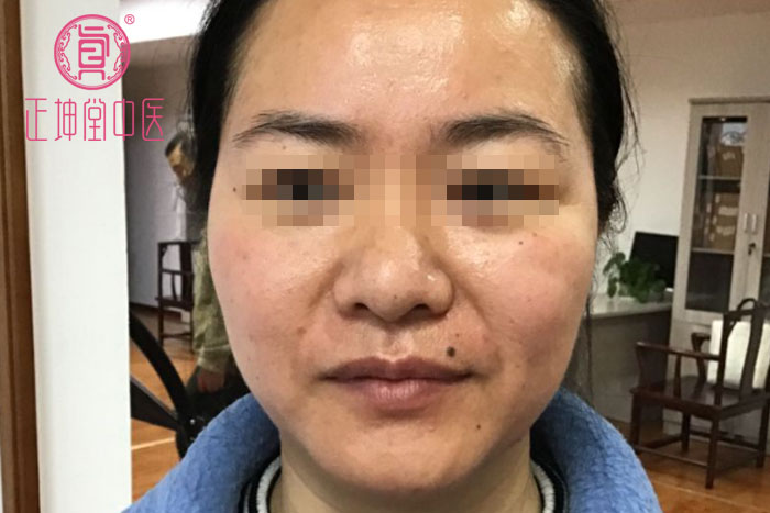女人衰老的主要原因