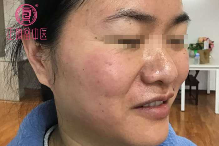 女人衰老的主要原因