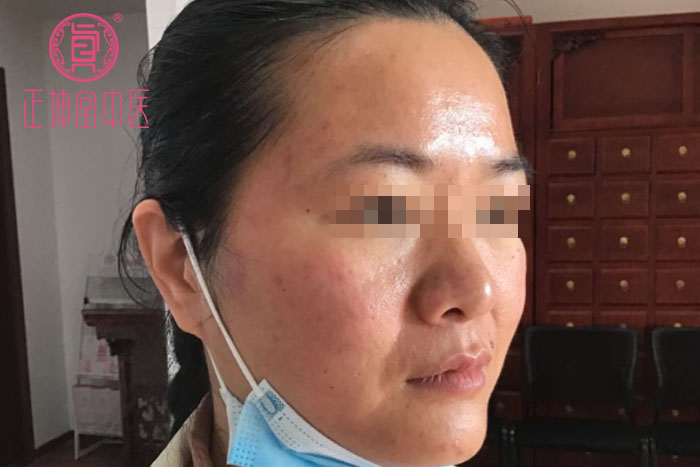 女人衰老的主要原因