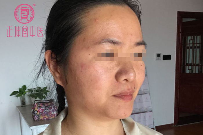 女人衰老的主要原因