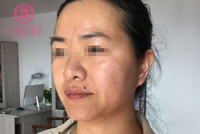 女人衰老的主要原因
