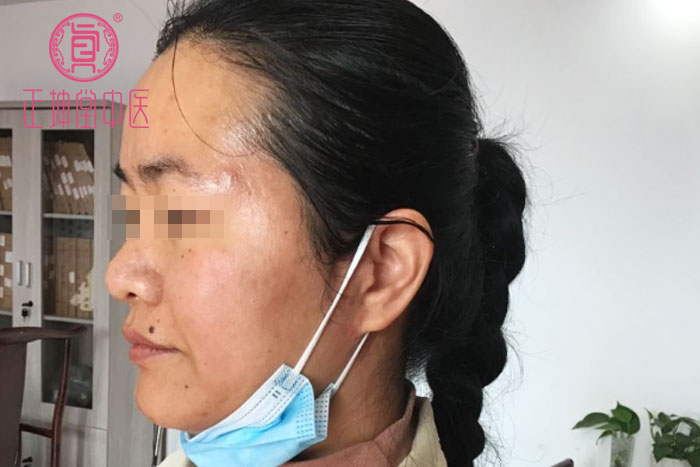 女人衰老的主要原因