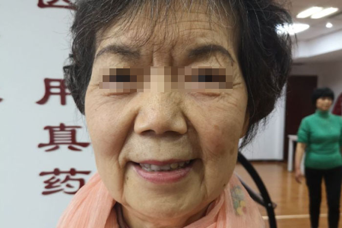 龙女士老年期衰老治愈案例
