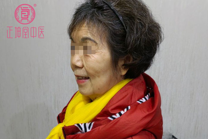 老年期衰老该怎么办