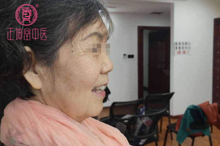 老年期衰老该怎么办