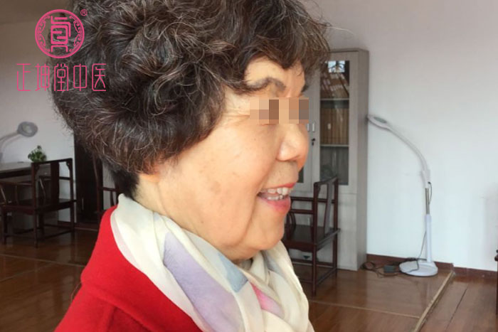 老年期衰老该怎么办