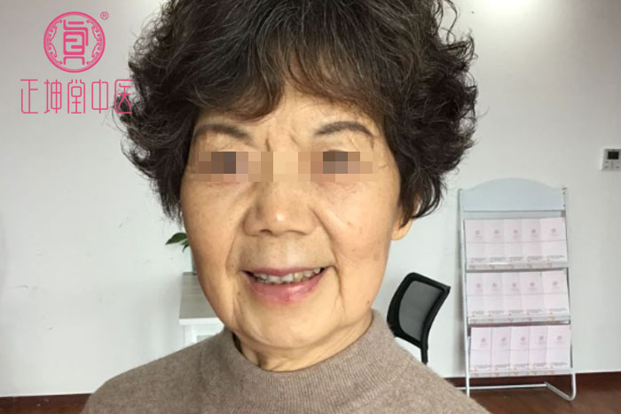 老年期衰老该怎么办
