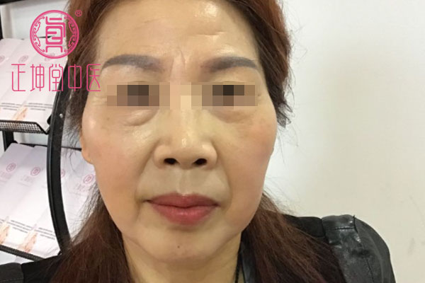 老年期衰老如何调理