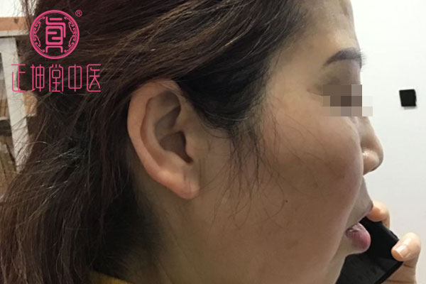 老年期衰老如何调理