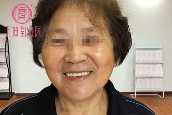 老年期衰老治愈案例