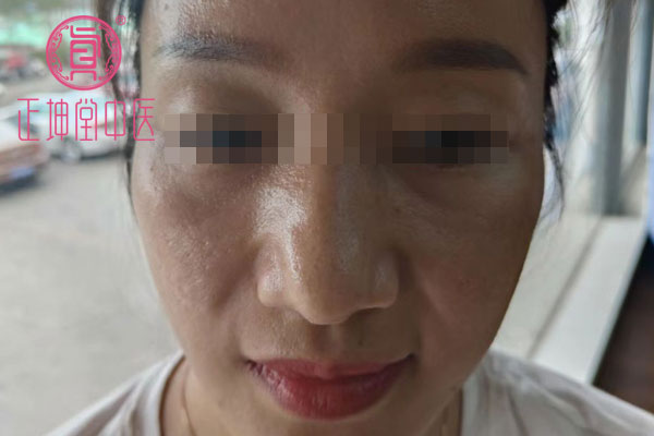 产后皮肤粗糙干燥怎么办