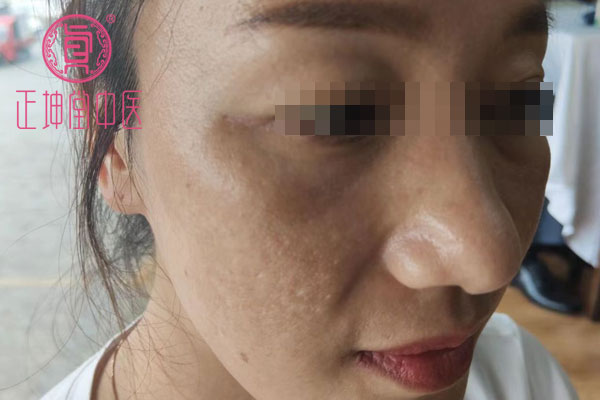 产后皮肤粗糙干燥怎么办