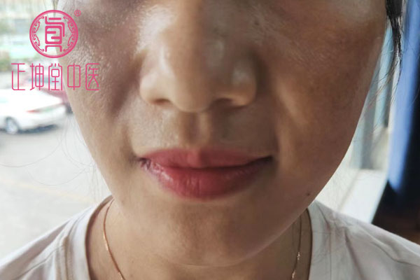 产后皮肤粗糙干燥怎么办