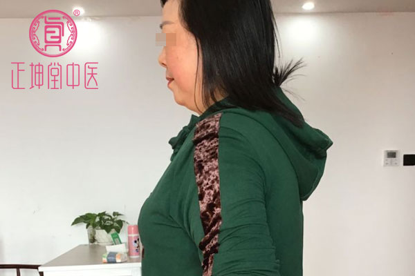 老年期衰老皮肤松弛干燥