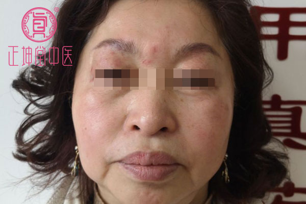 更年期衰老如何调理