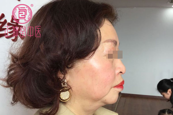 更年期衰老如何调理