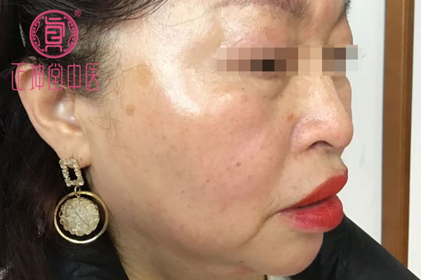更年期衰老如何调理