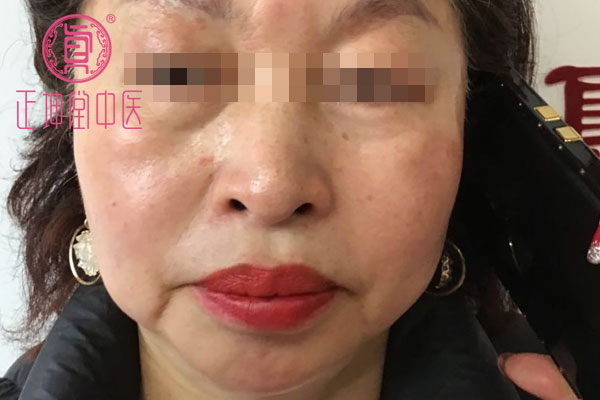 更年期衰老如何调理
